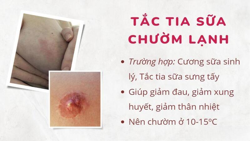 Chườm lạnh cũng là một biện pháp hiệu quả để giảm đau