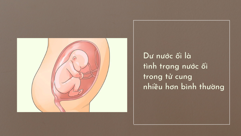 Dư nước ối là tình trạng như thế nào?