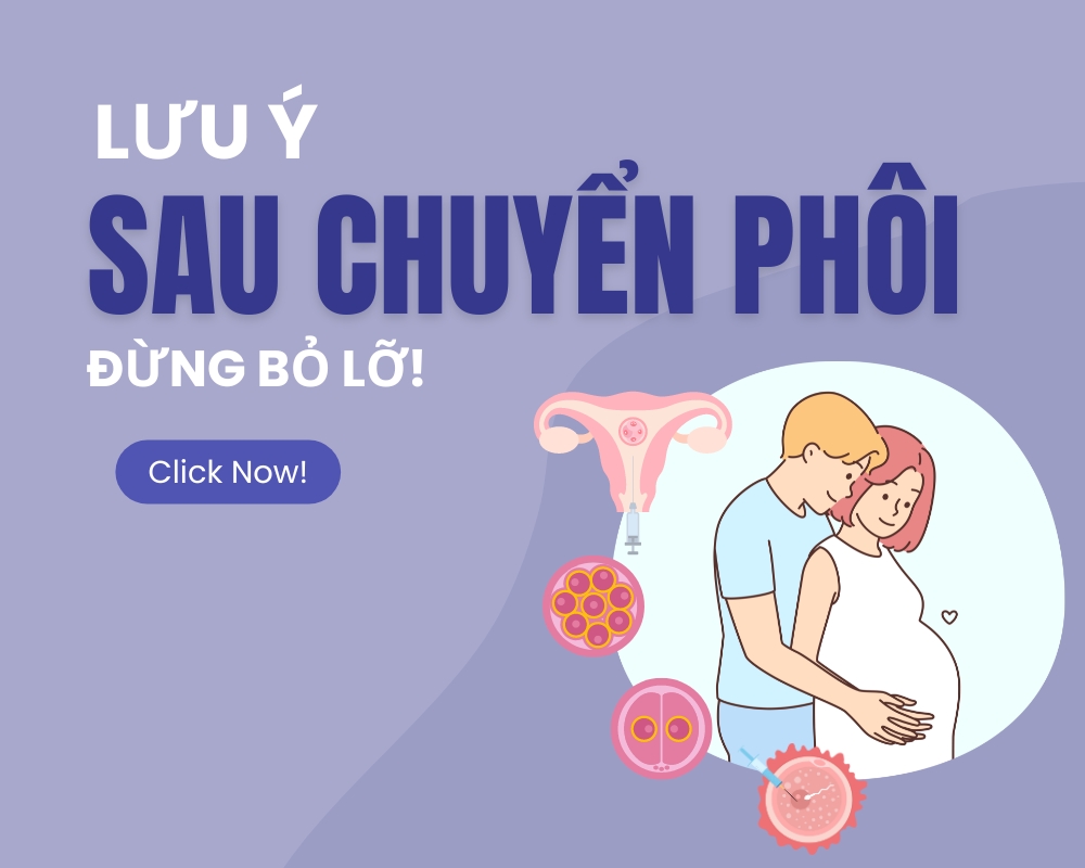 Lưu ý sau chuyển phôi