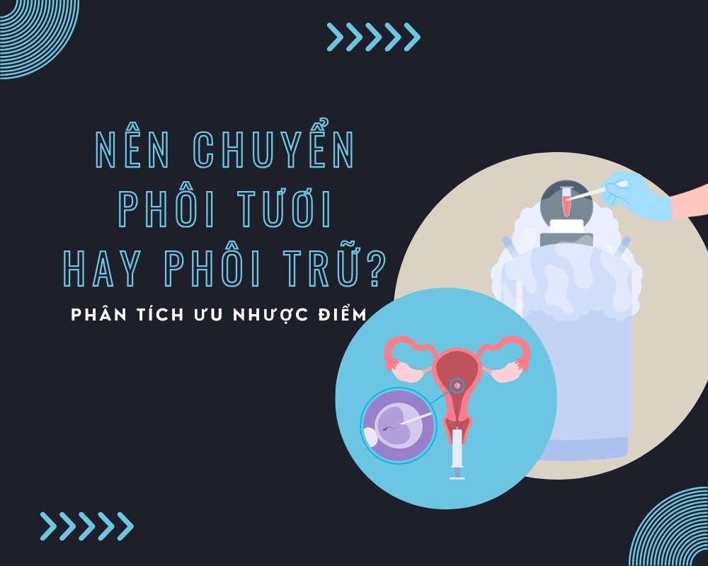 Nên chuyển phôi tươi hay phôi trữ