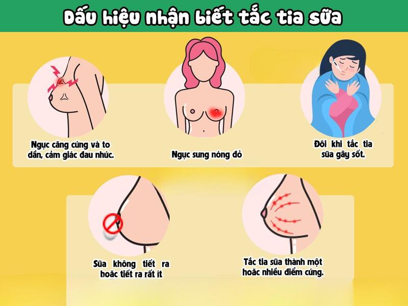 Dấu hiệu của tình trạng tắc tia sữa