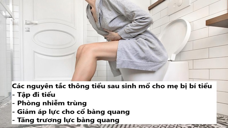 nguyên tắc thông tiểu sau sinh mổ